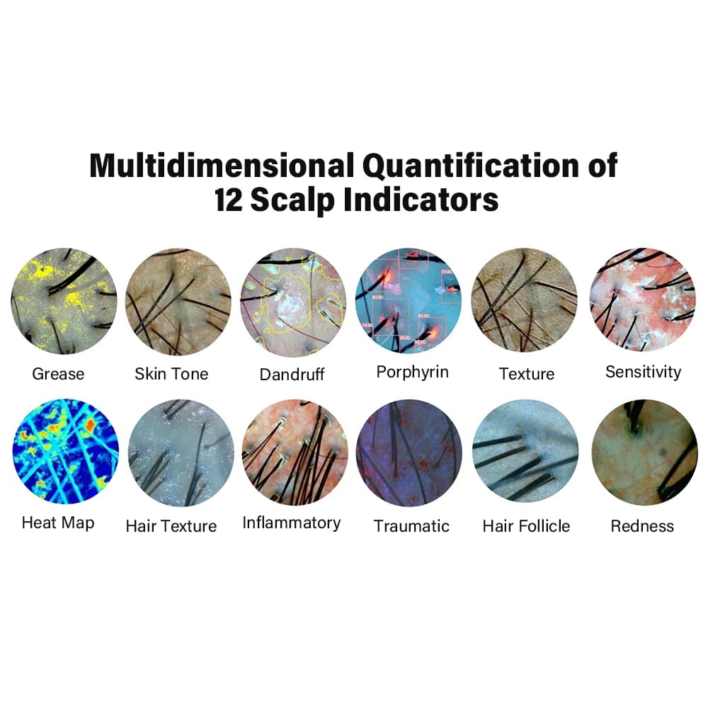 New Tech Portable Intelligent Hair Scalp Analysis Machine With — image 6