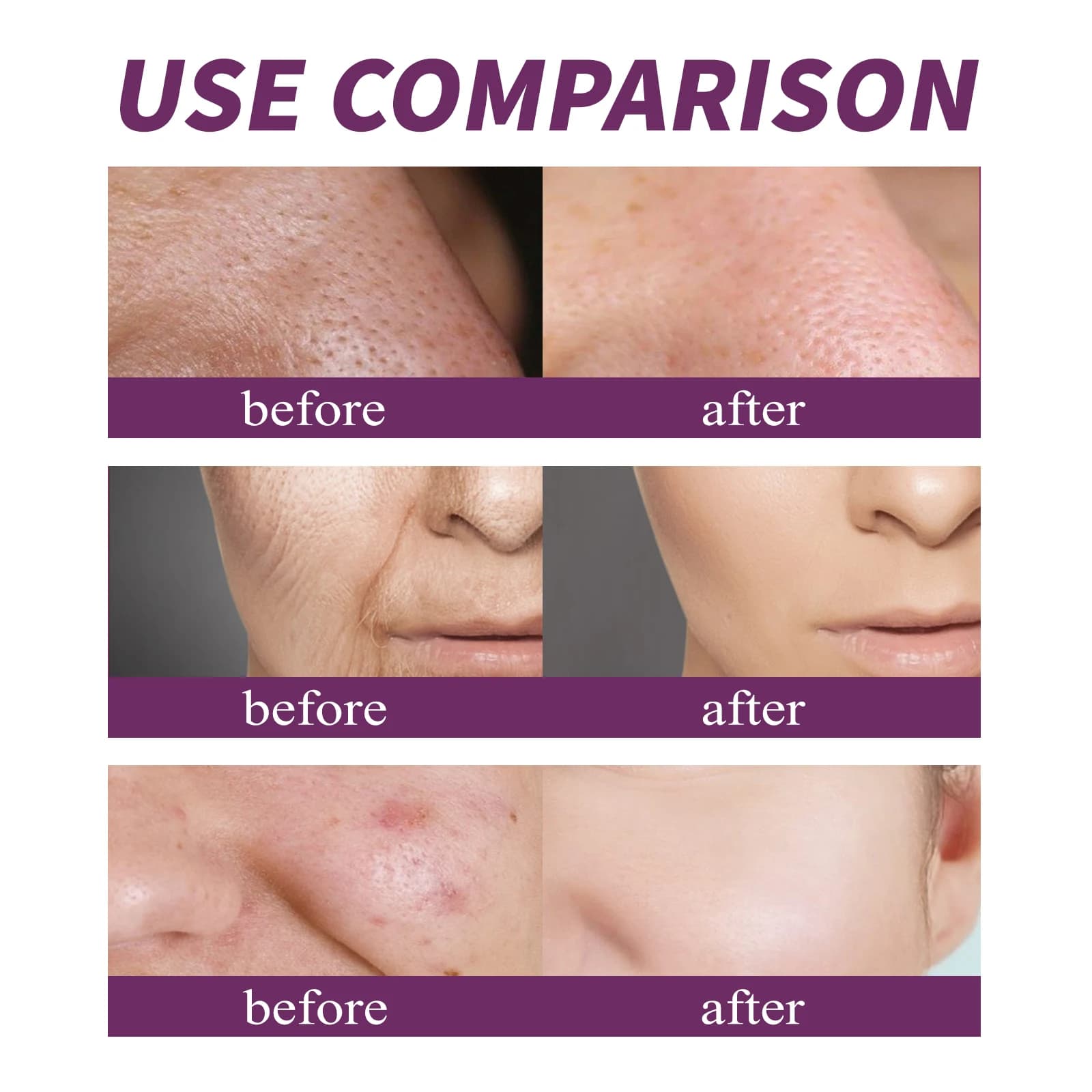20% niacinamide serum bottle — image 4