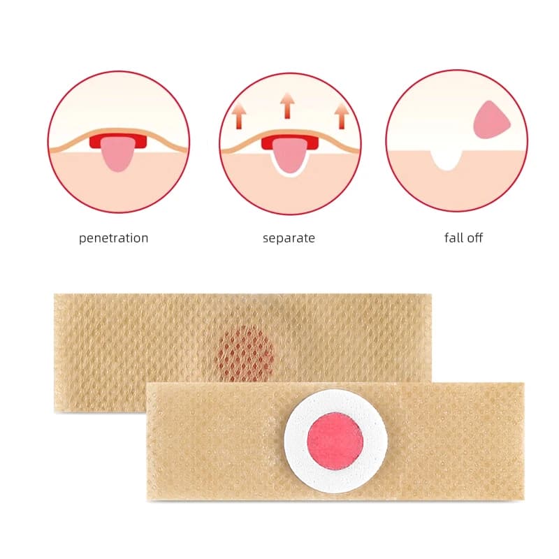 adhesive foot care patch pack — image 2