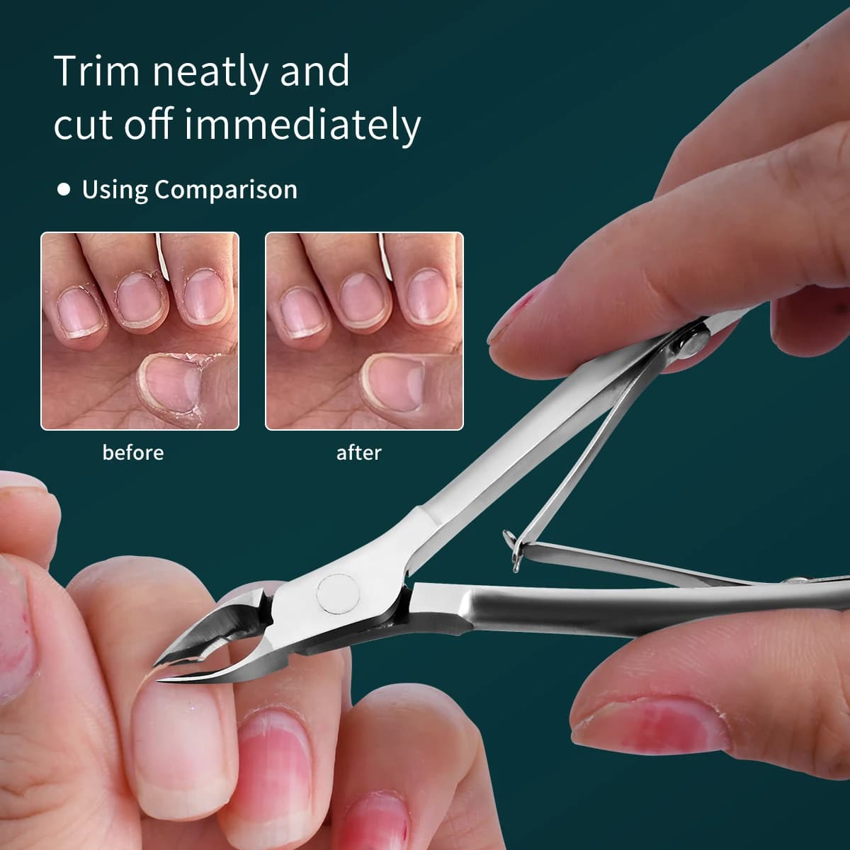 cuticle trimmer set with sharp scissors — image 5