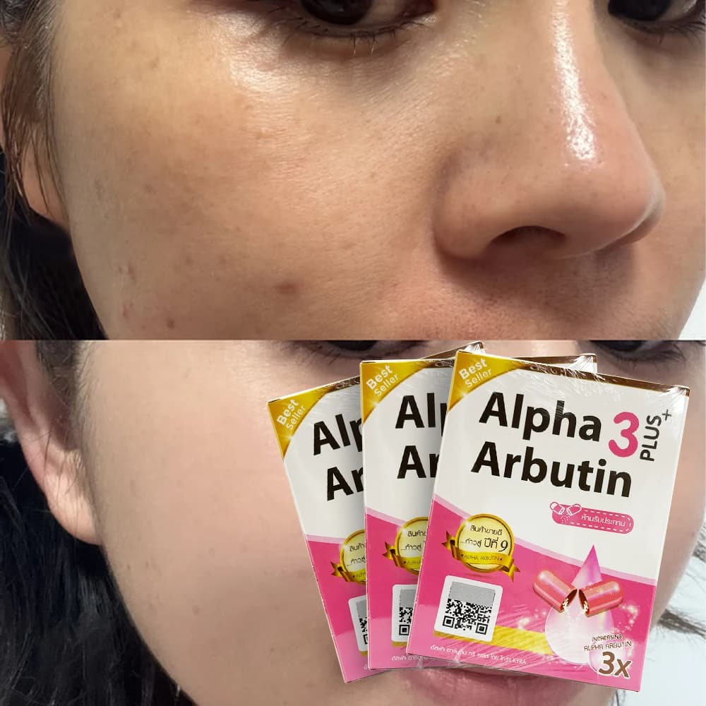 Alpha Arbutin 3 Plus powder and lotion set — image 5