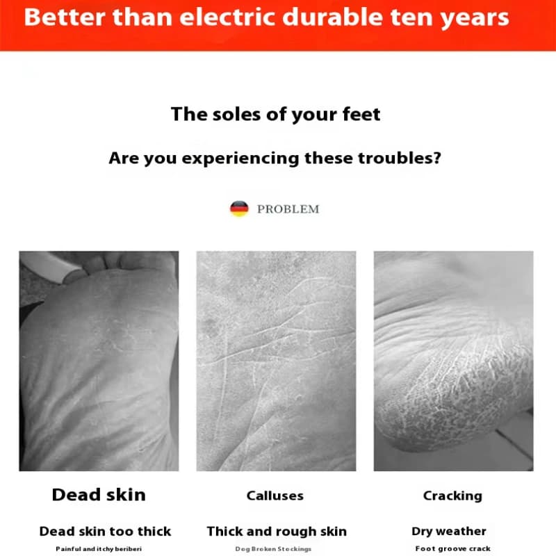 Nano foot callus remover tool — image 4