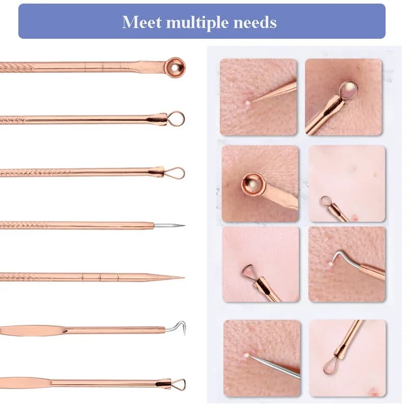 set of four ultra‑fine blackhead extractor needles — image 2