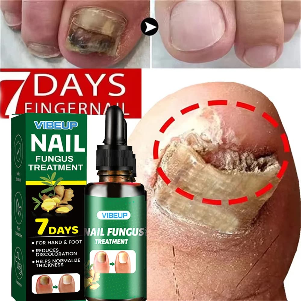 Fungal nail treatment serum bottle — image 3