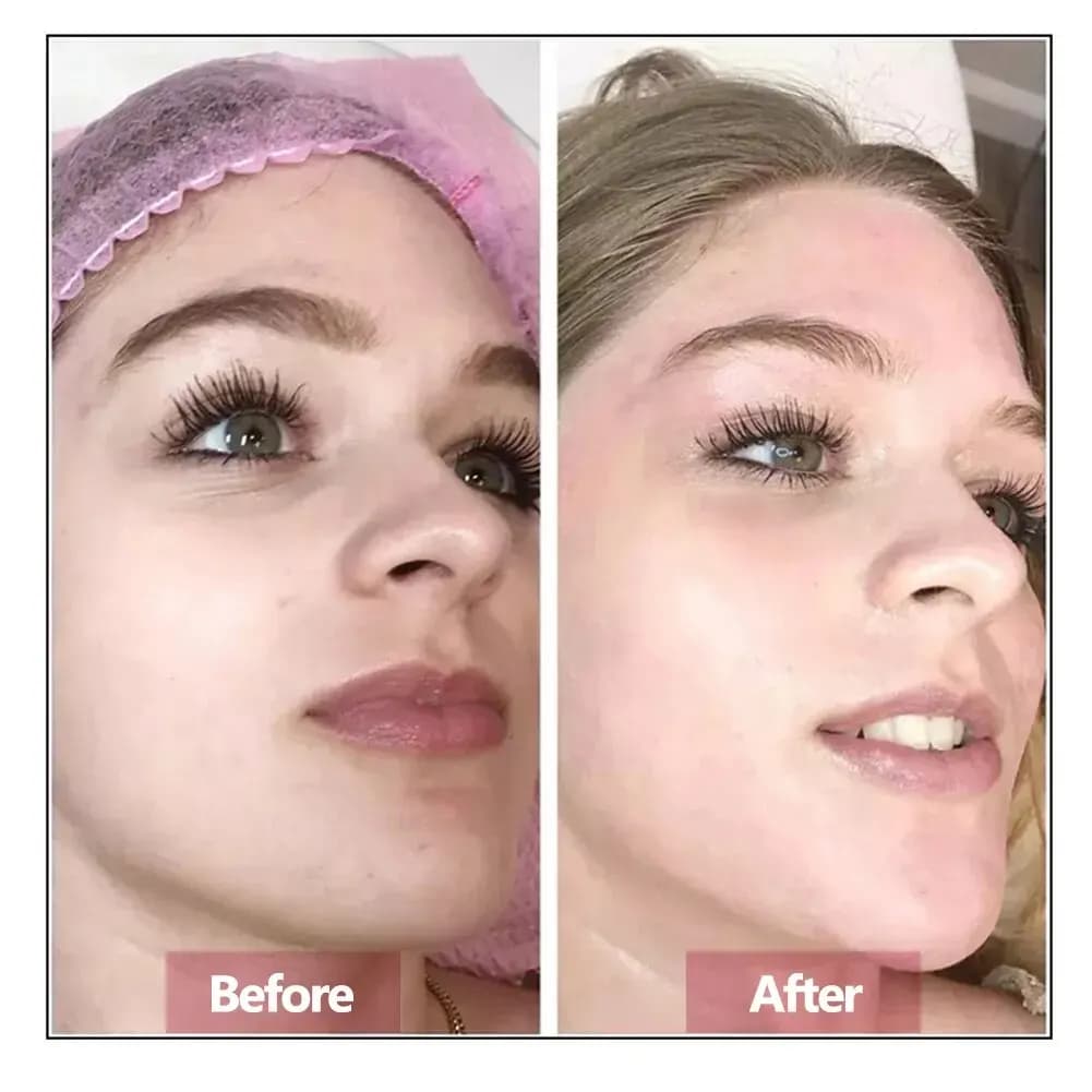 Hyaluronic acid face serum bottle — image 3