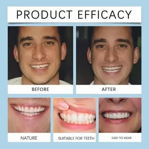 silicone denture liner kit for upper and lower dentures — image 4