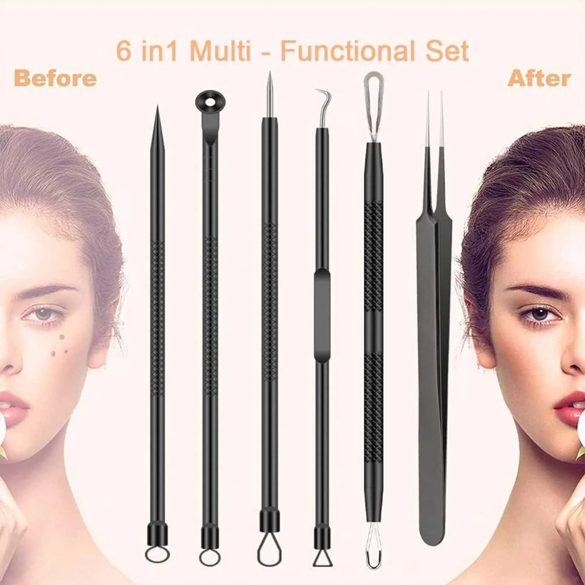 stainless steel 6-piece acne tool set with blackhead extractor — image 6