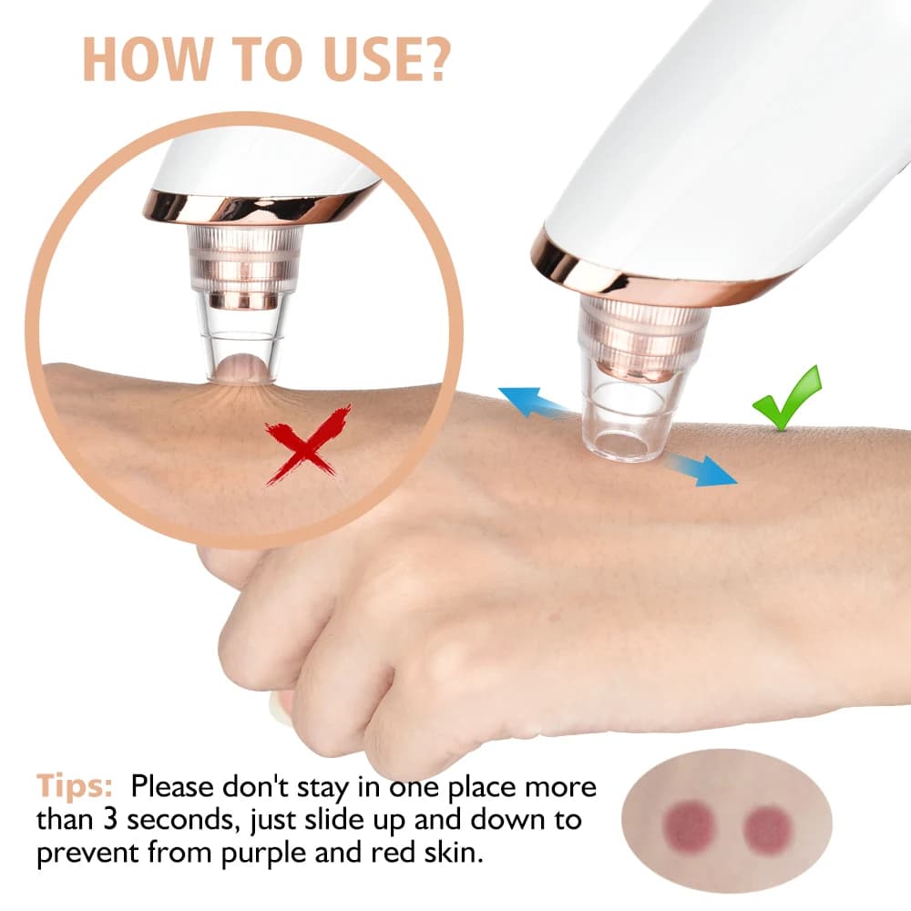 USB rechargeable facial pore vacuum cleaner — image 5