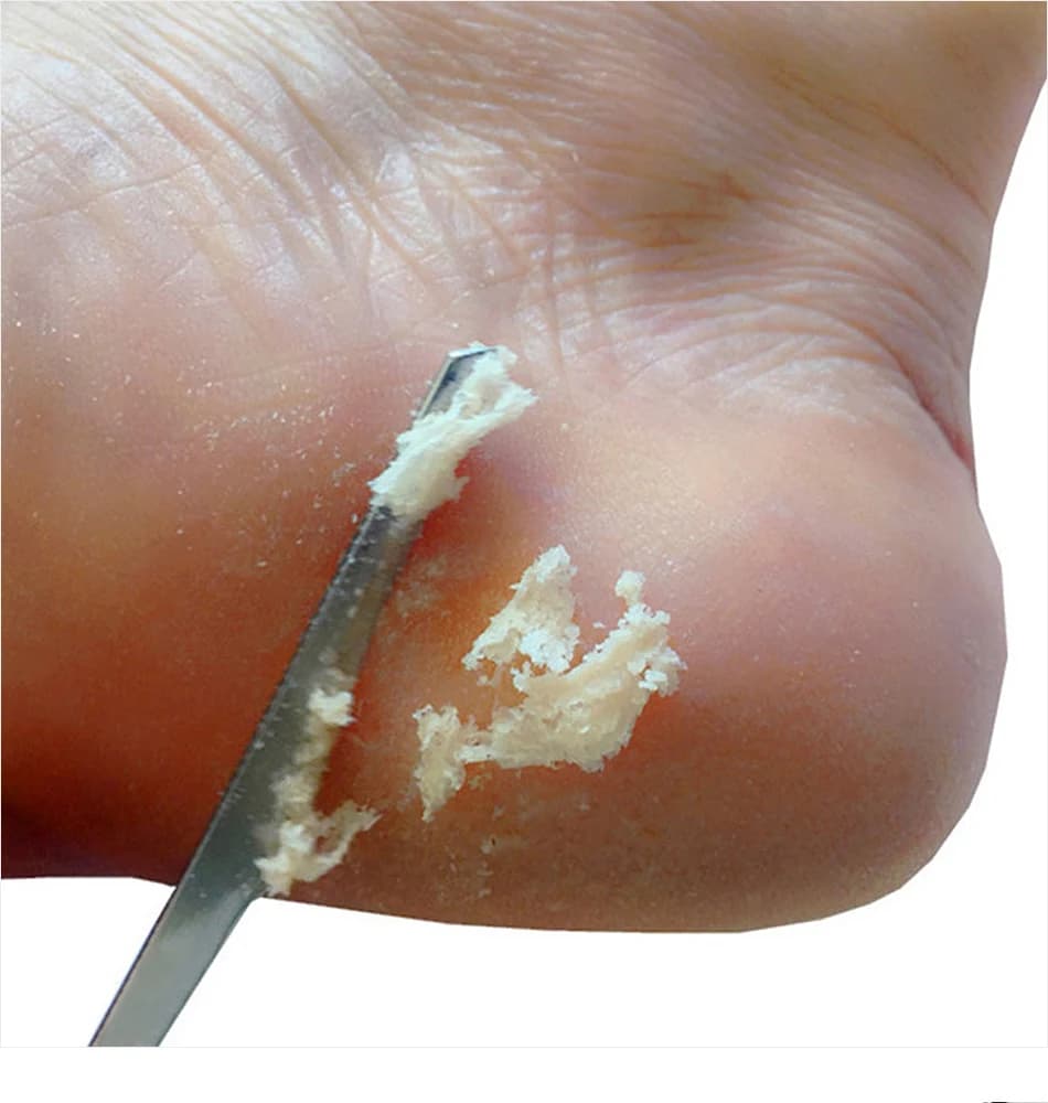 Stainless steel foot file and callus remover tool — image 5