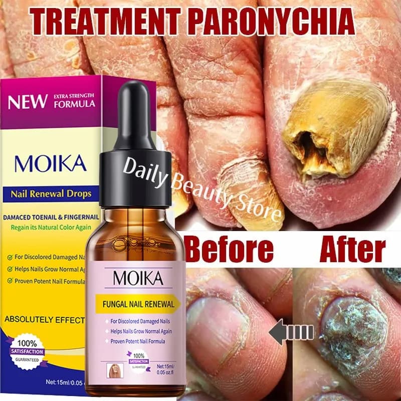 nail fungus treatment serum bottle — image 1