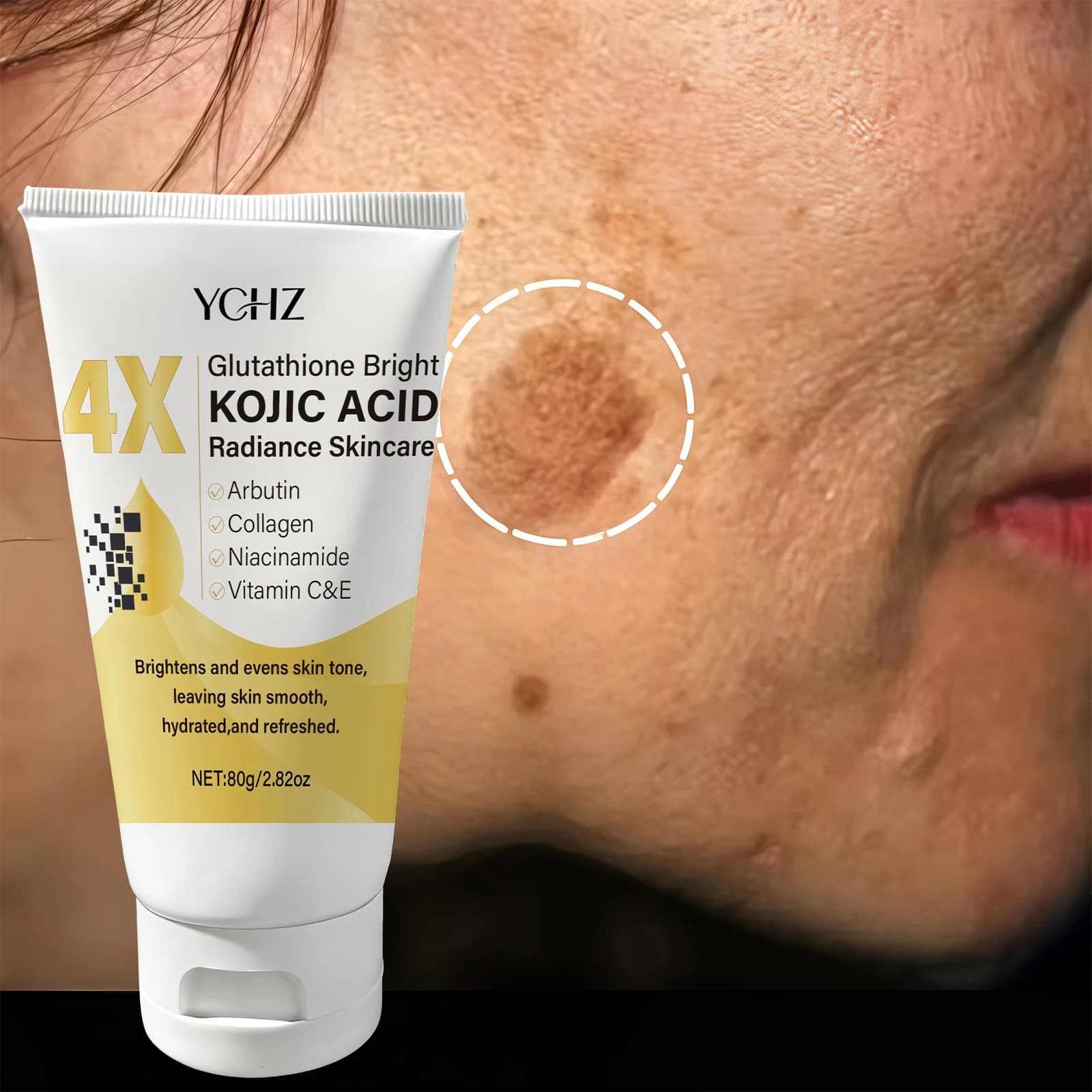 Kojic Acid Face Cream – Even Skin Tone