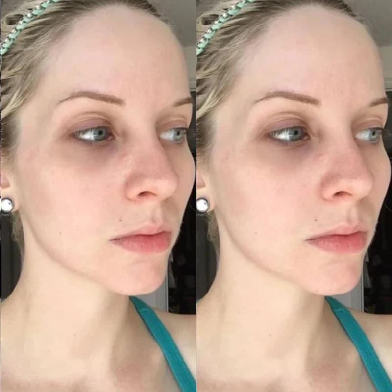 collagen peptide hyaluronic acid facial mask sheet — image 6