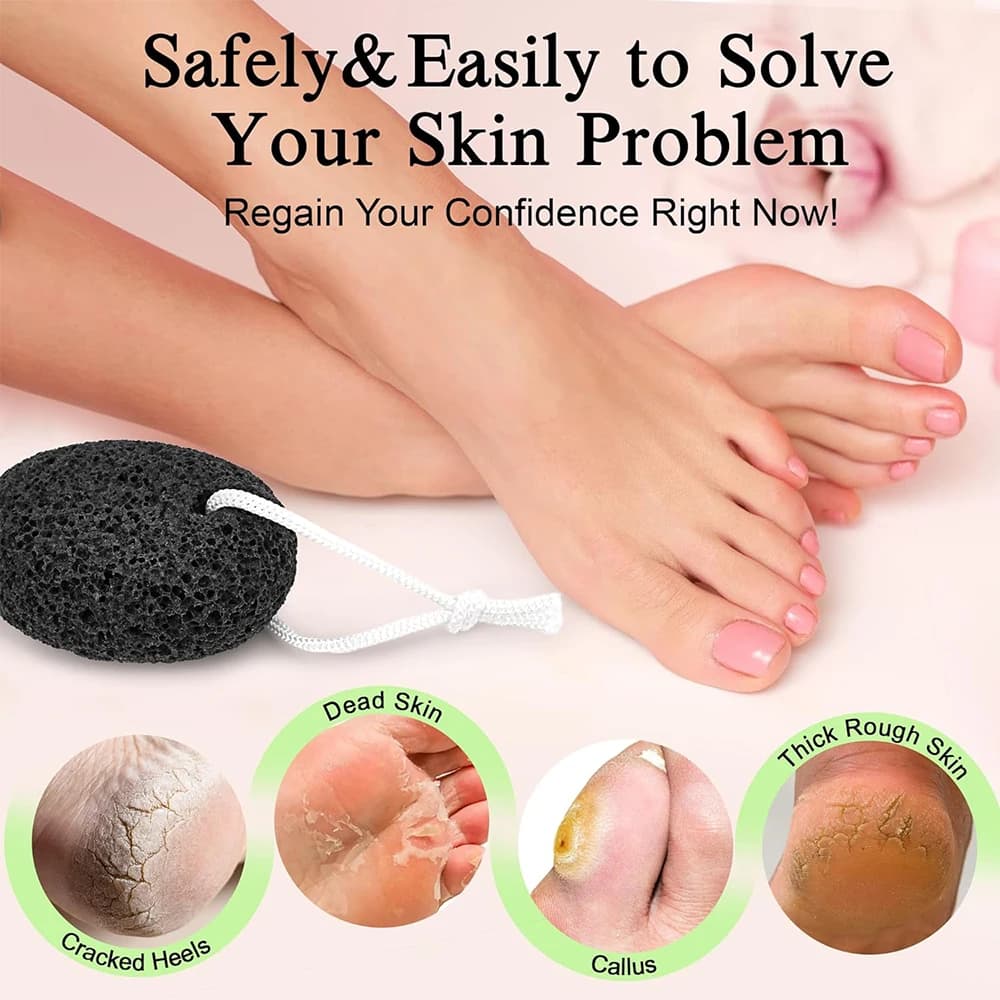 Lava pumice stone for removing foot and hand calluses — image 5