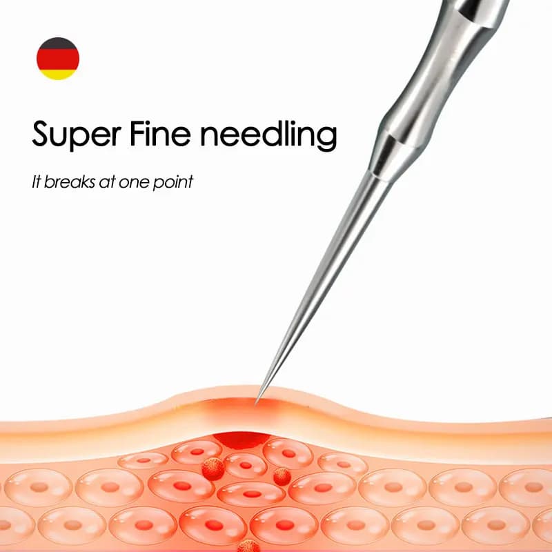 handheld blackhead extractor tool with needle tips — image 5