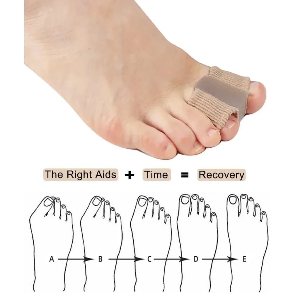 soft toe separator for bunion relief — image 6