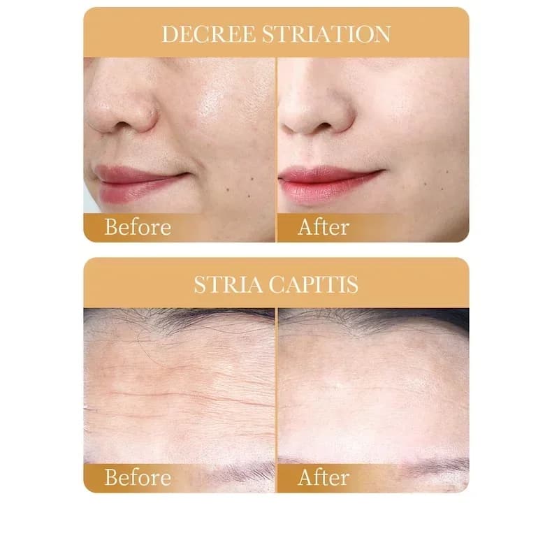 collagen anti-wrinkle face mask sheet pack — image 5