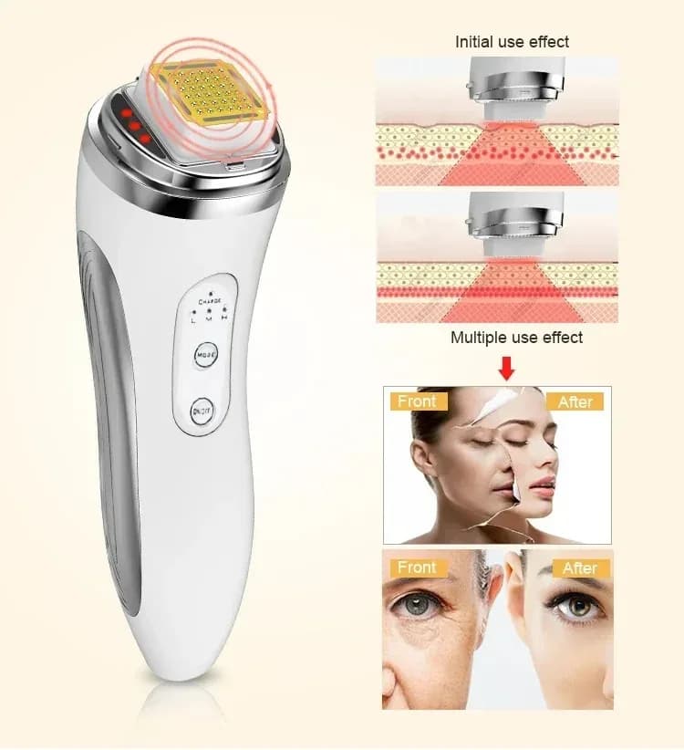electric facial lifting and skin tightening device — image 3