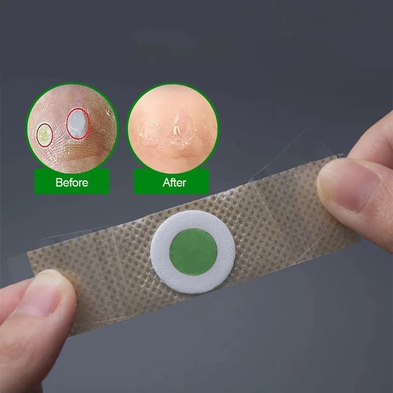 foot corn removal patches pack of 12 — image 6