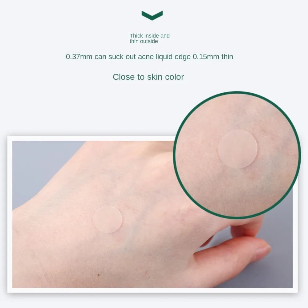 transparent acne pimple patch — image 3