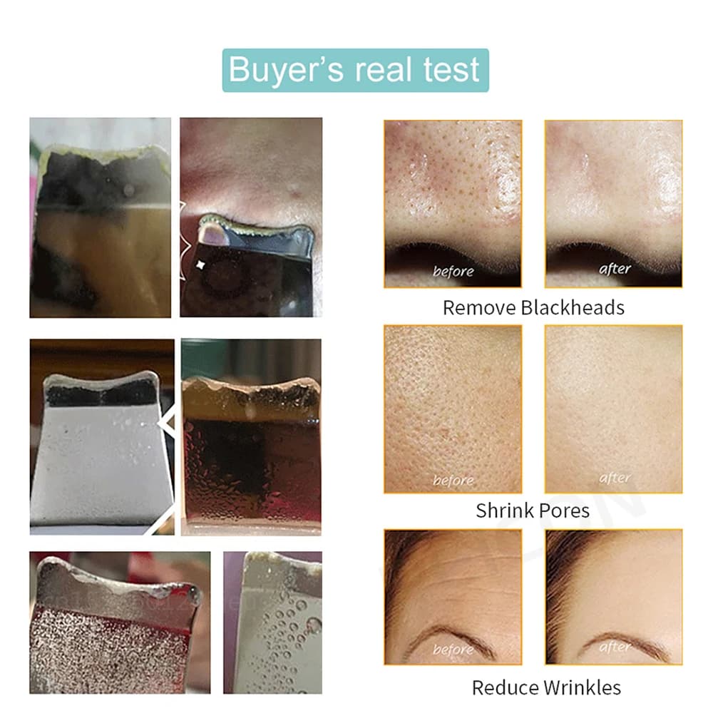 handheld ultrasonic skin scrubber device — image 6