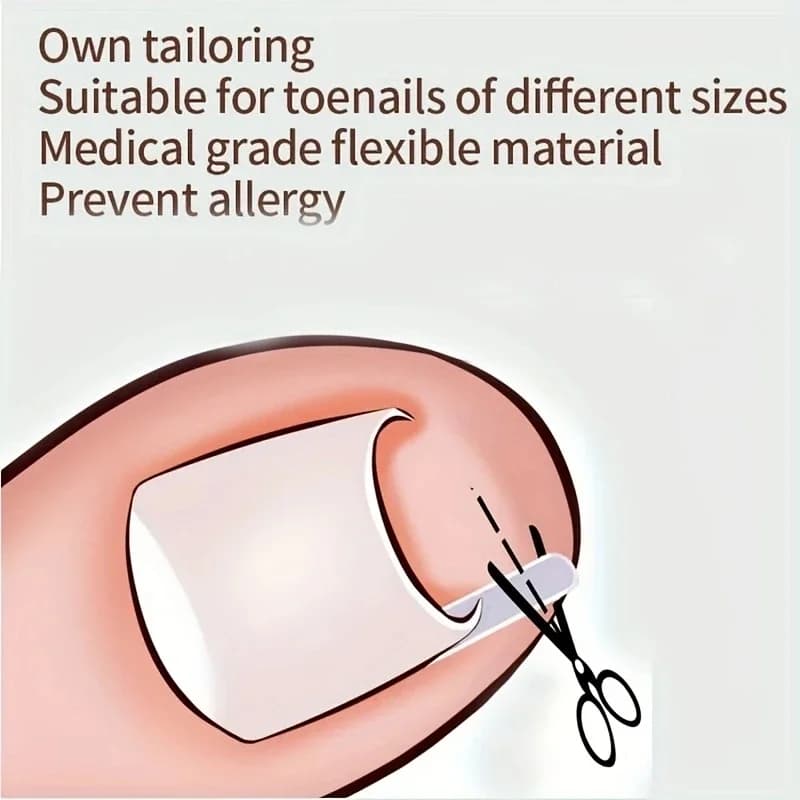 pack of 50 invisible ingrown toenail correction clips — image 5