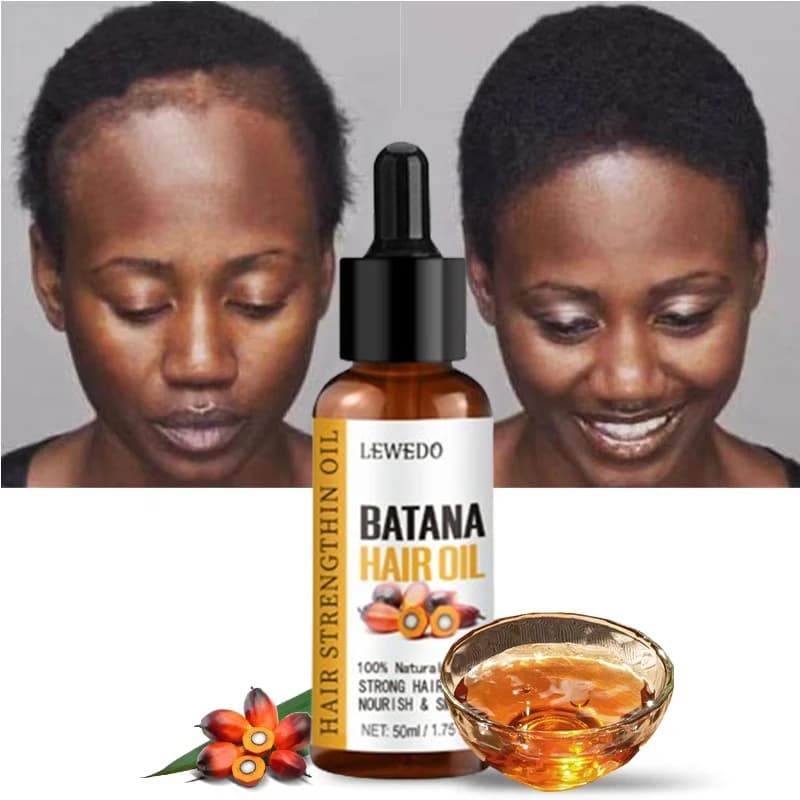 Lewedo Naturals Batana Oil – Nourishing Hair Growth