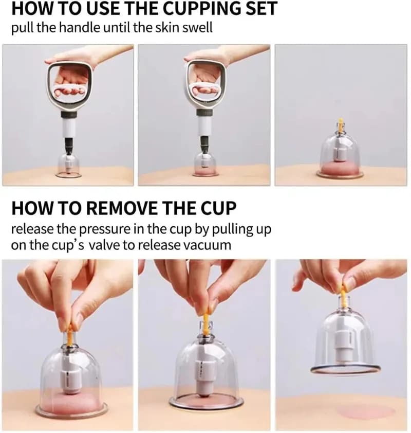 vacuum cupping therapy set with suction cups — image 5