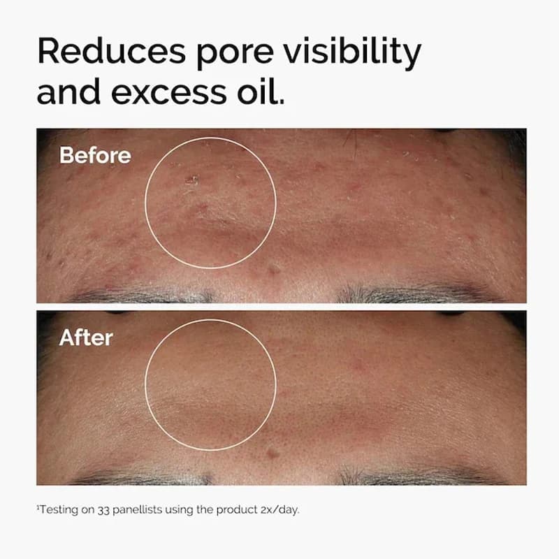 30 ml bottle of niacinamide 10% plus zinc 1% serum — image 6