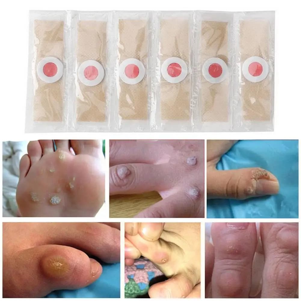 Self‑adhesive toe and foot protector pads — image 3