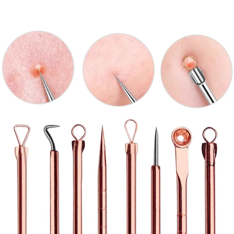 set of four ultra‑fine blackhead extractor needles — image 3