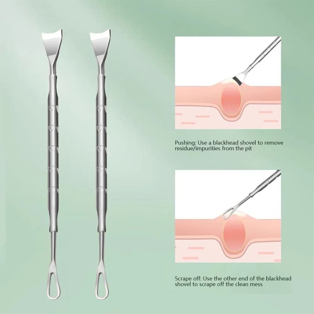 handheld blackhead remover tool with stainless steel tip — image 6