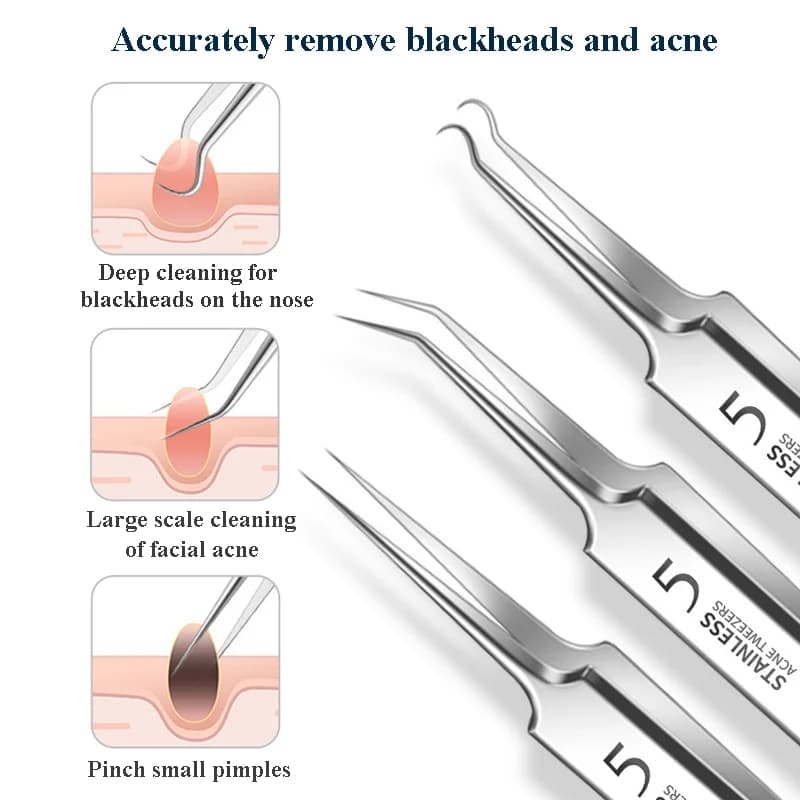 Ingrown hair tweezers with multiple needle tips — image 2