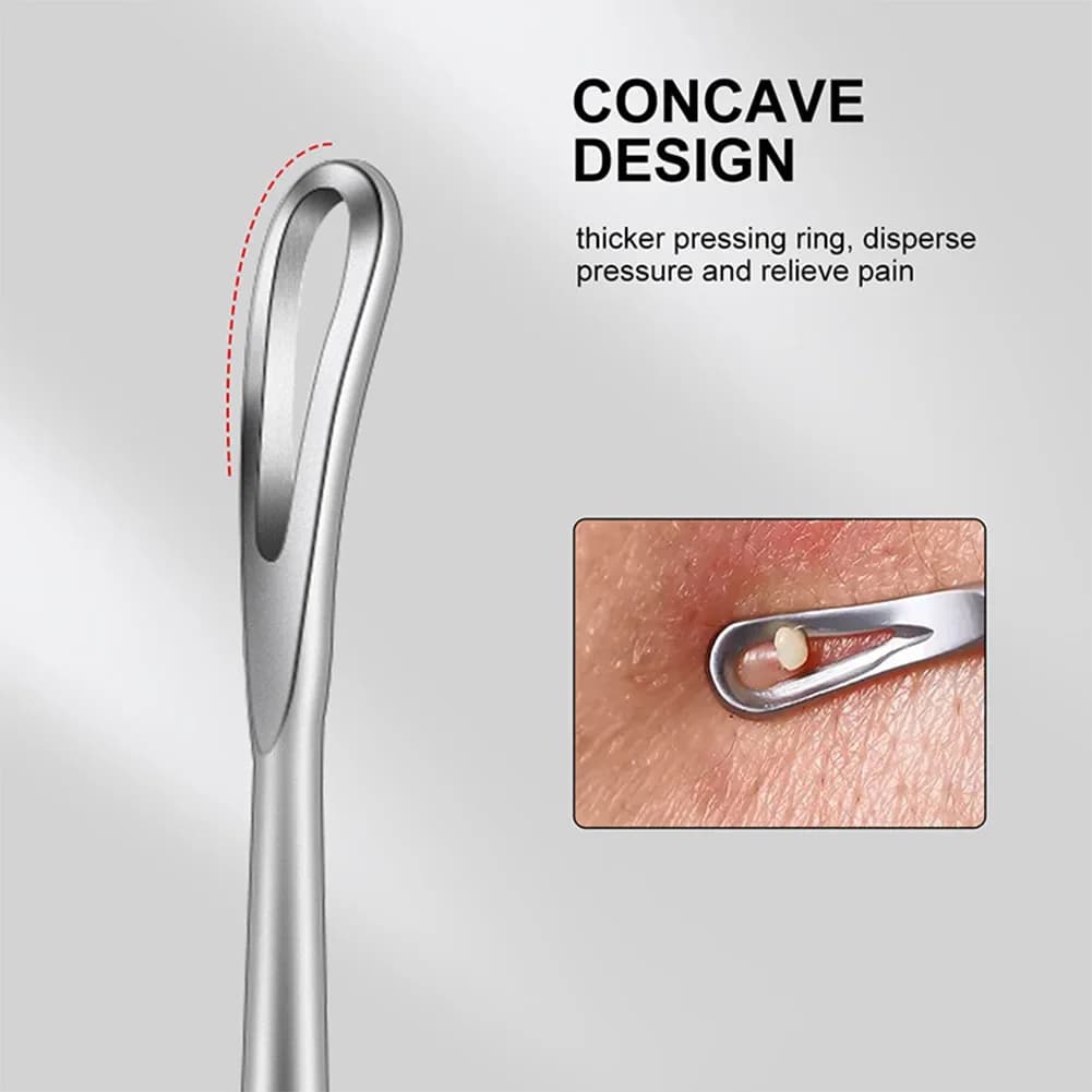 Blackhead Remover Pimple Popper Tool