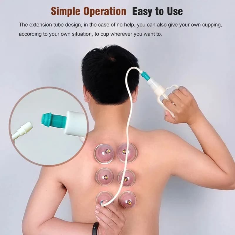 32-piece vacuum cupping massage set — image 4