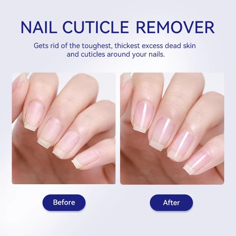 Lilycute cuticle remover gel 30ml bottle — image 5