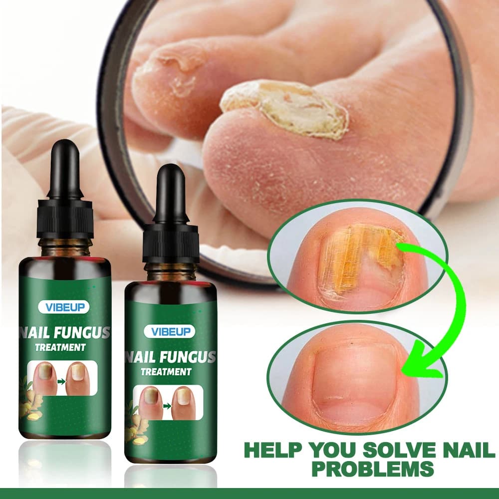 Fungal nail treatment serum bottle — image 6