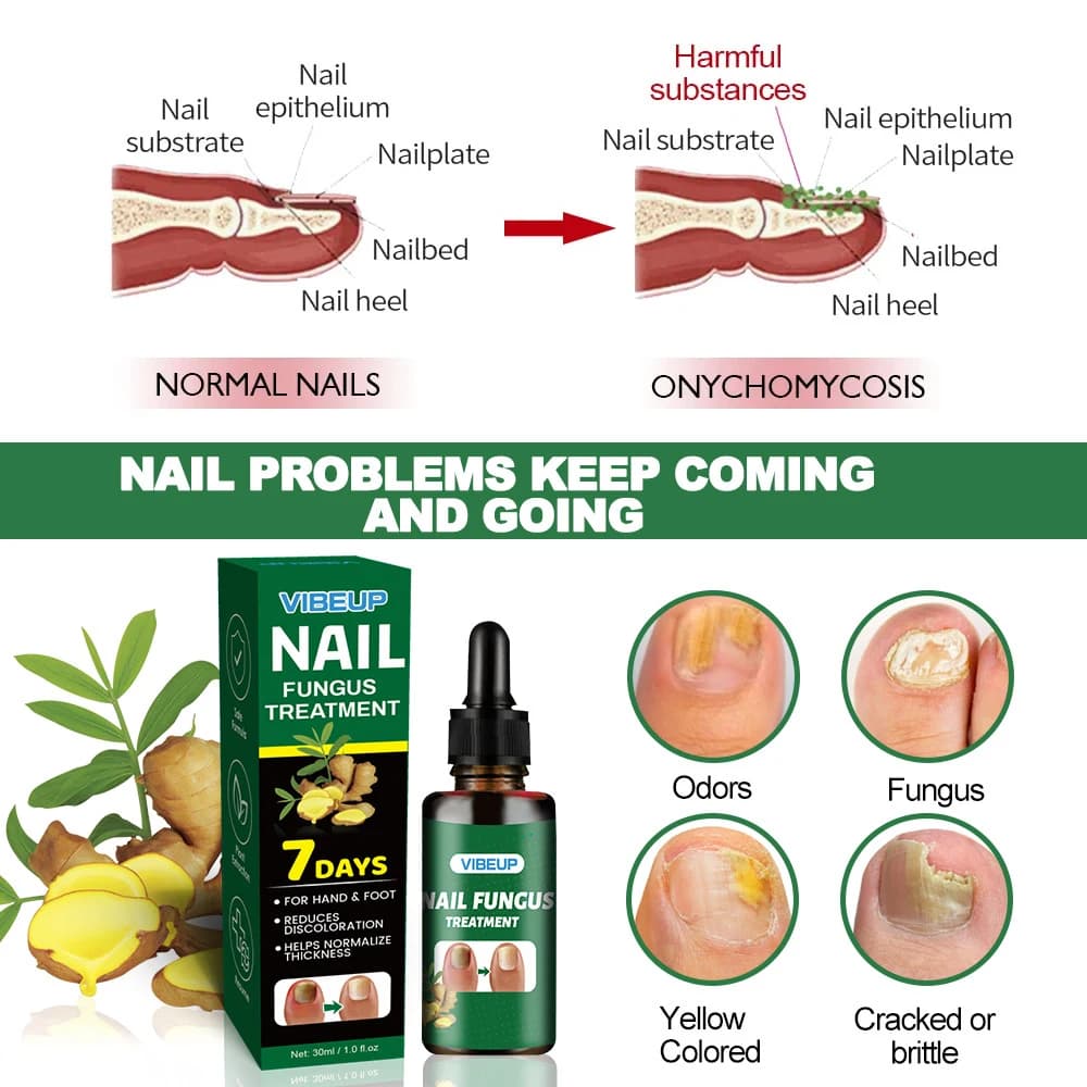 Fungal nail treatment serum bottle — image 5