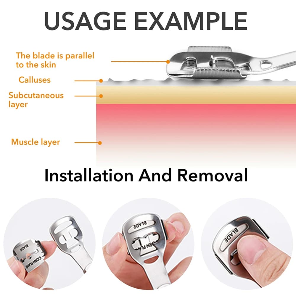 Foot callus remover set with stainless steel blades and wooden handle — image 5
