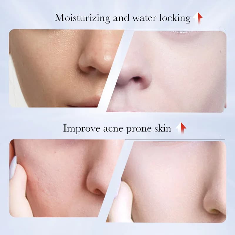 Kojic acid brightening face cream tube — image 3