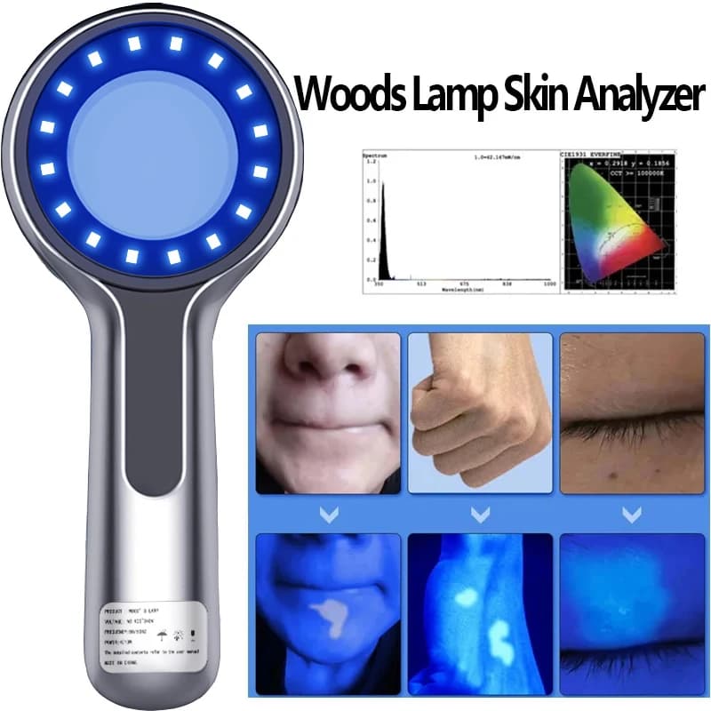 handheld wood lamp for skin analysis — image 6