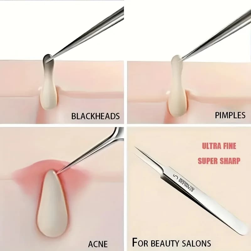 extra fine No.5 cellular acne blackhead tweezers set — image 2