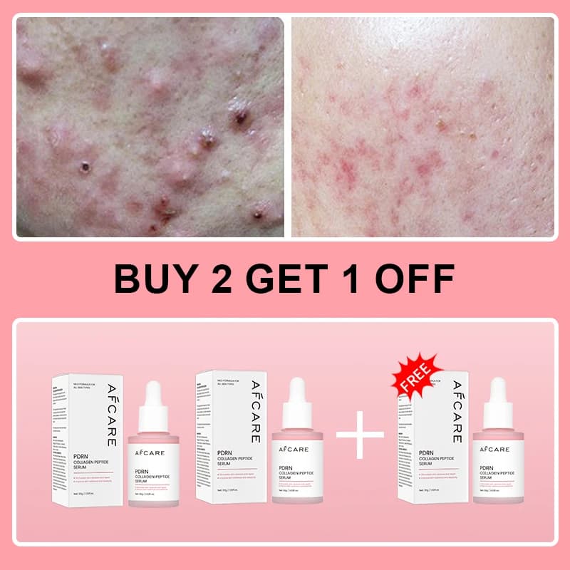 collagen peptide facial serum bottle — image 7