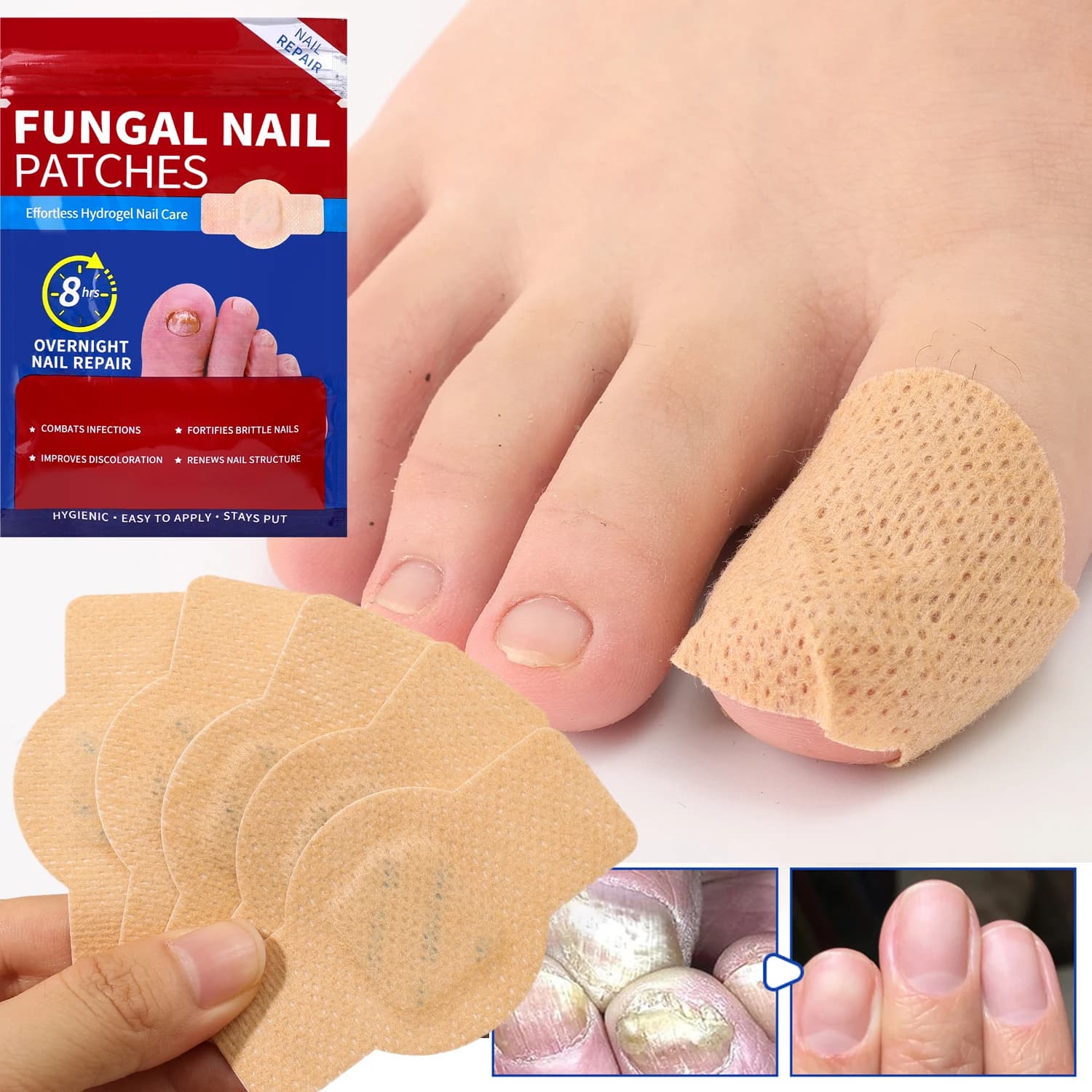 sticky nail repair patches for fungus and ingrown toenails — image 5