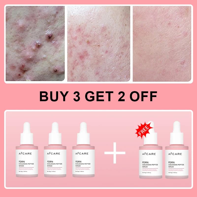 collagen peptide facial serum bottle — image 8