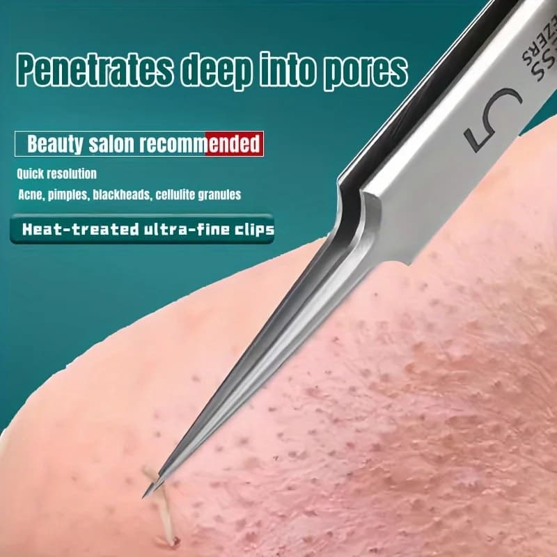 stainless steel blackhead removal tweezers — image 2