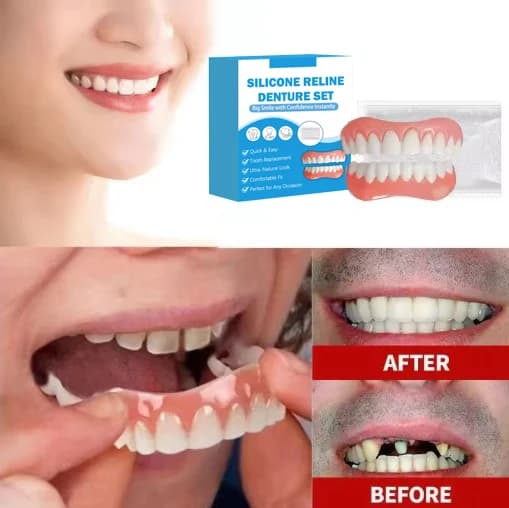 silicone denture liner kit for upper and lower dentures — image 3