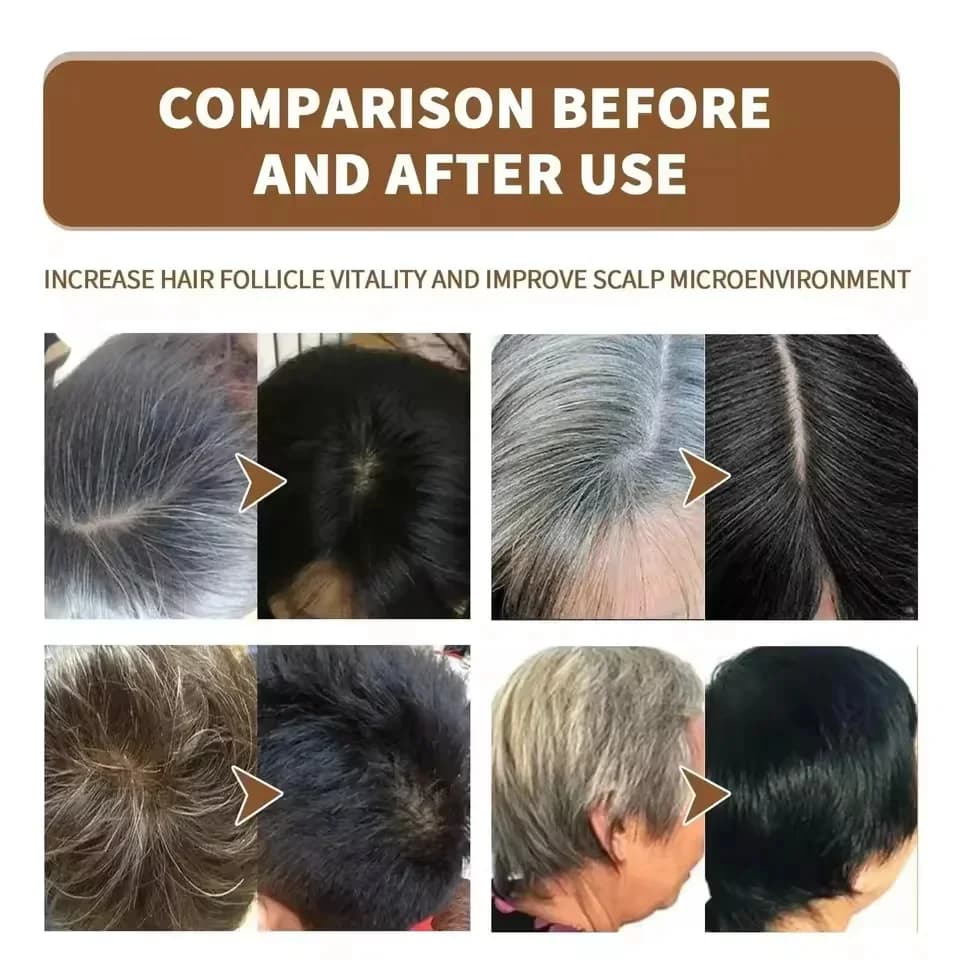 gray hair darkening serum bottle — image 4