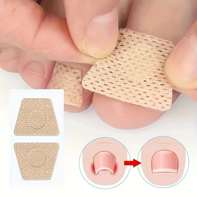 soft nail repair patch for fungal and ingrown nails — image 2