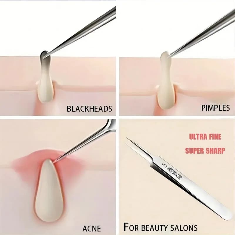 extra fine #5 acne and blackhead removal tweezers — image 5