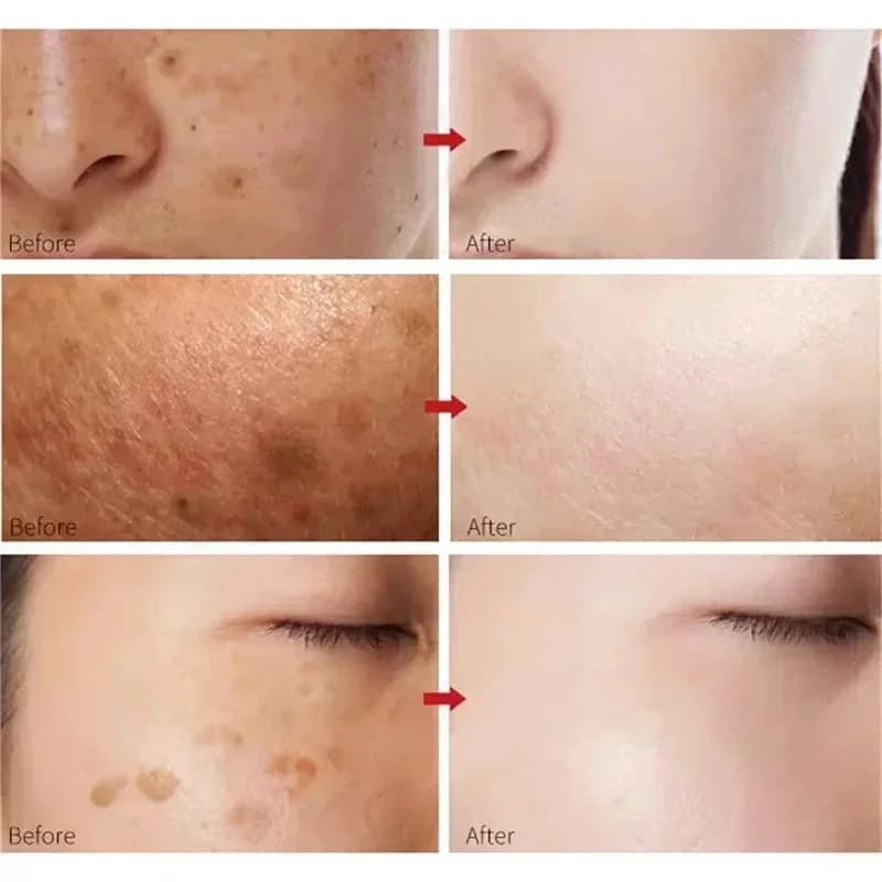Kojic acid whitening essence bottle — image 2